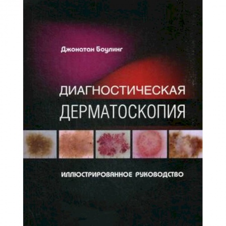 Кожные и венерические болезни, книга Диагностическая дерматоскопия. Иллюстрированное руководство купить по низкой цене