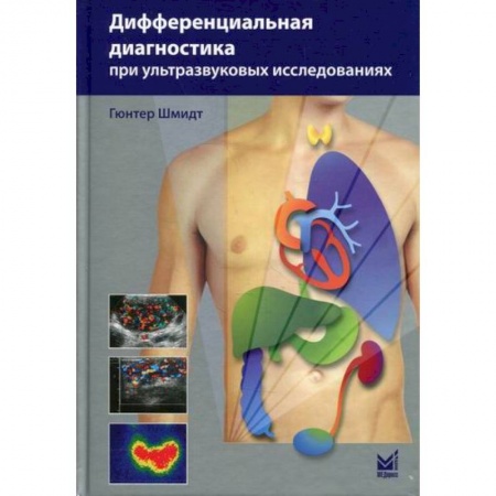 УЗИ. ЭКГ. Томография. Рентген, книга Дифференциальная диагностика при ультразвуковых исследованиях купить по низкой цене