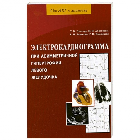 Книги, книга Электрокардиограмма при асимметричной гипертрофии левого желудочка купить по низкой цене