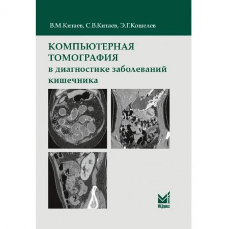 УЗИ. ЭКГ. Томография. Рентген, книга Компьютерная томография в диагностике заболеваний кишечника купить по низкой цене