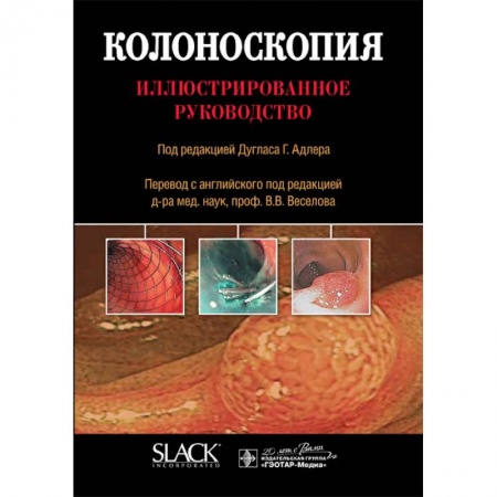 Гастроэнтерология, книга Колоноскопия. Иллюстрированное руководство купить по низкой цене