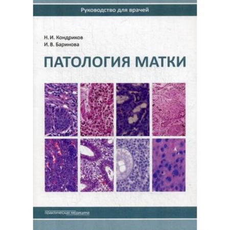 Акушерство и гинекология, книга Патология матки. Руководство для врачей купить по низкой цене