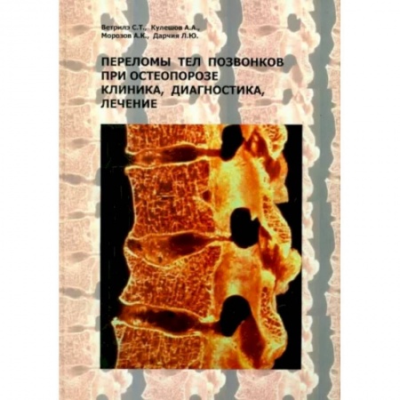 Хирургия. Ортопедия, книга Переломы тел позвонков при остеопорозе. Клиника, диагностика, лечение купить по низкой цене