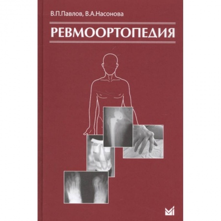 Хирургия. Ортопедия, книга Ревмоортопедия купить по низкой цене