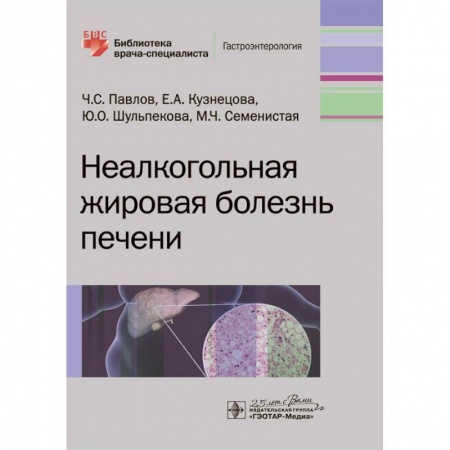 Диагностика и лечение, книга Неалкогольная жировая болезнь печени купить по низкой цене