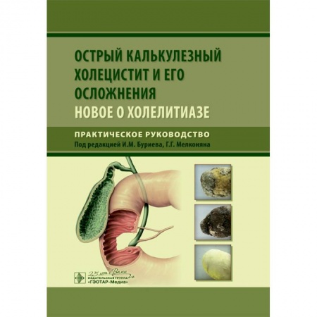 Хирургия. Ортопедия, книга Острый калькулезный холецистит и его осложнения. Новое о холелитиазе купить по низкой цене