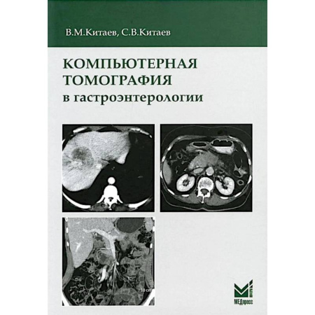 УЗИ. ЭКГ. Томография. Рентген, книга Компьютерная томография в гастроэнтерологии: руководство для врачей. купить по низкой цене