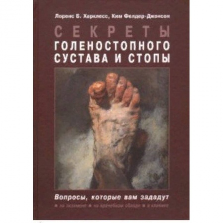 Хирургия. Ортопедия, книга Секреты голеностопного сустава и стопы купить по низкой цене
