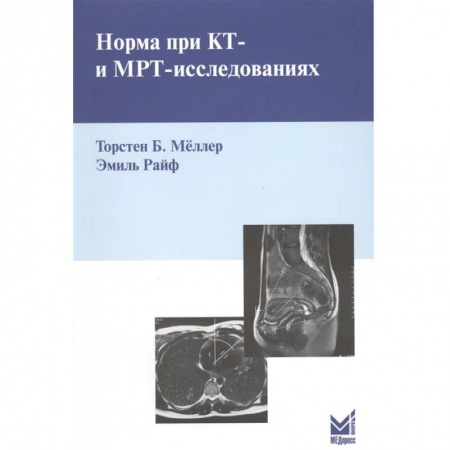 Фармакология. Рецептура. Токсикология, книга Норма при КТ- и МРТ-исследованиях. Мёллер Т.Б. купить по низкой цене