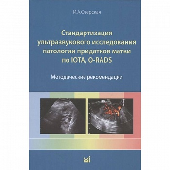 Стандартизация ультразвукового исследования патологии придатков матки по IOTA, O-RADS. Методические рекомендации