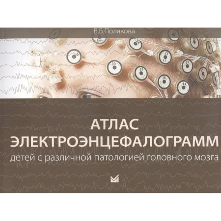 Неврология, книга Атлас электроэнцефалограмм детей с различной патологией головного мозга купить по низкой цене