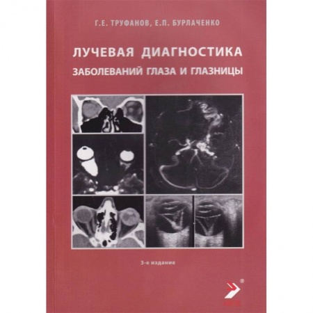 Специальная медицина, книга Лучевая диагностика заболеваний глаза и глазницы купить по низкой цене