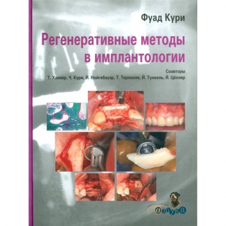 Стоматология, книга Регенеративные методы в имплантологии купить по низкой цене