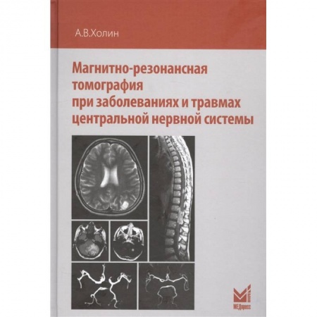 УЗИ. ЭКГ. Томография. Рентген, книга Магнитно-резонансная томография при заболеваниях и травмах центральной нервной системы купить по низкой цене