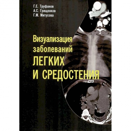 Органы дыхания. Туберкулез. Астма, книга Визуализация заболеваний легких и средостения купить по низкой цене