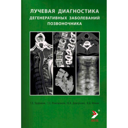 Диагностика. Методы и виды, книга Лучевая диагностика дегенеративных заболеваний позвоночника купить по низкой цене